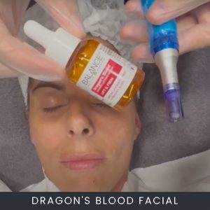 Dragons Blood Facial Course Online