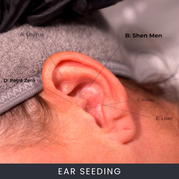 Ear Seeding Course Online Ear Seeding Course Online