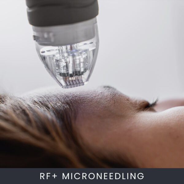 RF-Microneedling RF+ Microneedling