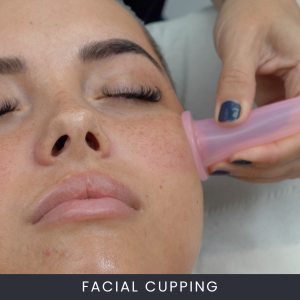 Facial Cupping Course Online