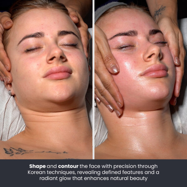 before and after of Korean Contour Facial Massage